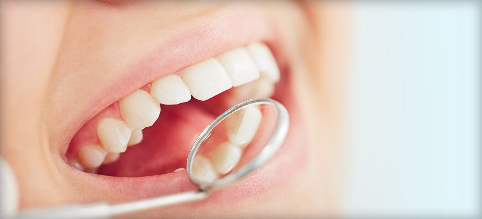 mirror showing inside of mouth